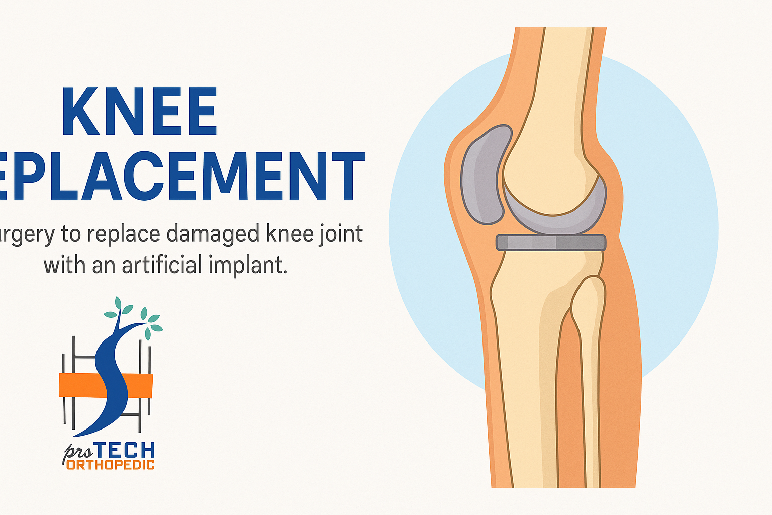 Knee Replacement Surgery